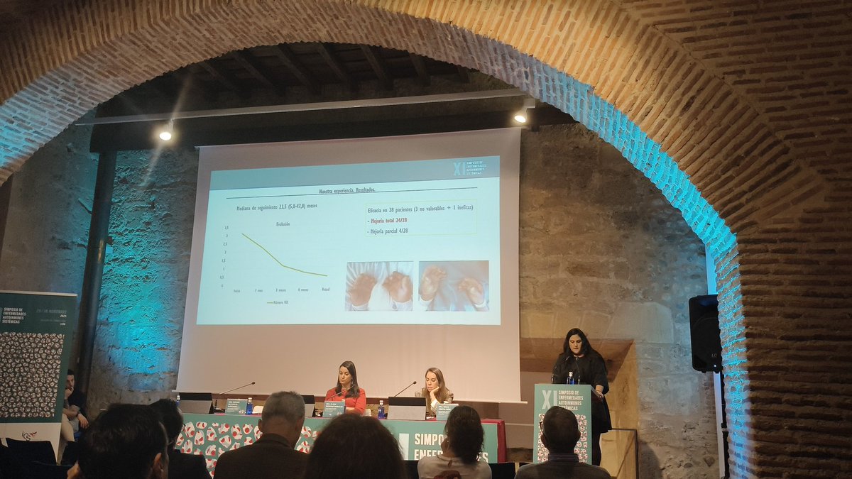 Reumatología León (@reumaleon) on Twitter photo #XISimposioEAS24
👉 La Dra <a href="/retuxximab/">Retuxximab</a> nos habla de úlceras digitales en SSc: manejo terapéutico y nuestra experiencia con macitentan
🔸Actualizaciones de EULAR de 2017 y 2023
🔸Novedades terapéuticas: tofafitinib/baricitinib/MTX?
🔸Nuestra experiencia con macitentan #XISimposioEAS24
👉 La Dra <a href="/retuxximab/">Retuxximab</a> nos habla de úlceras digitales en SSc: manejo terapéutico y nuestra experiencia con macitentan
🔸Actualizaciones de EULAR de 2017 y 2023
🔸Novedades terapéuticas: tofafitinib/baricitinib/MTX?
🔸Nuestra experiencia con macitentan