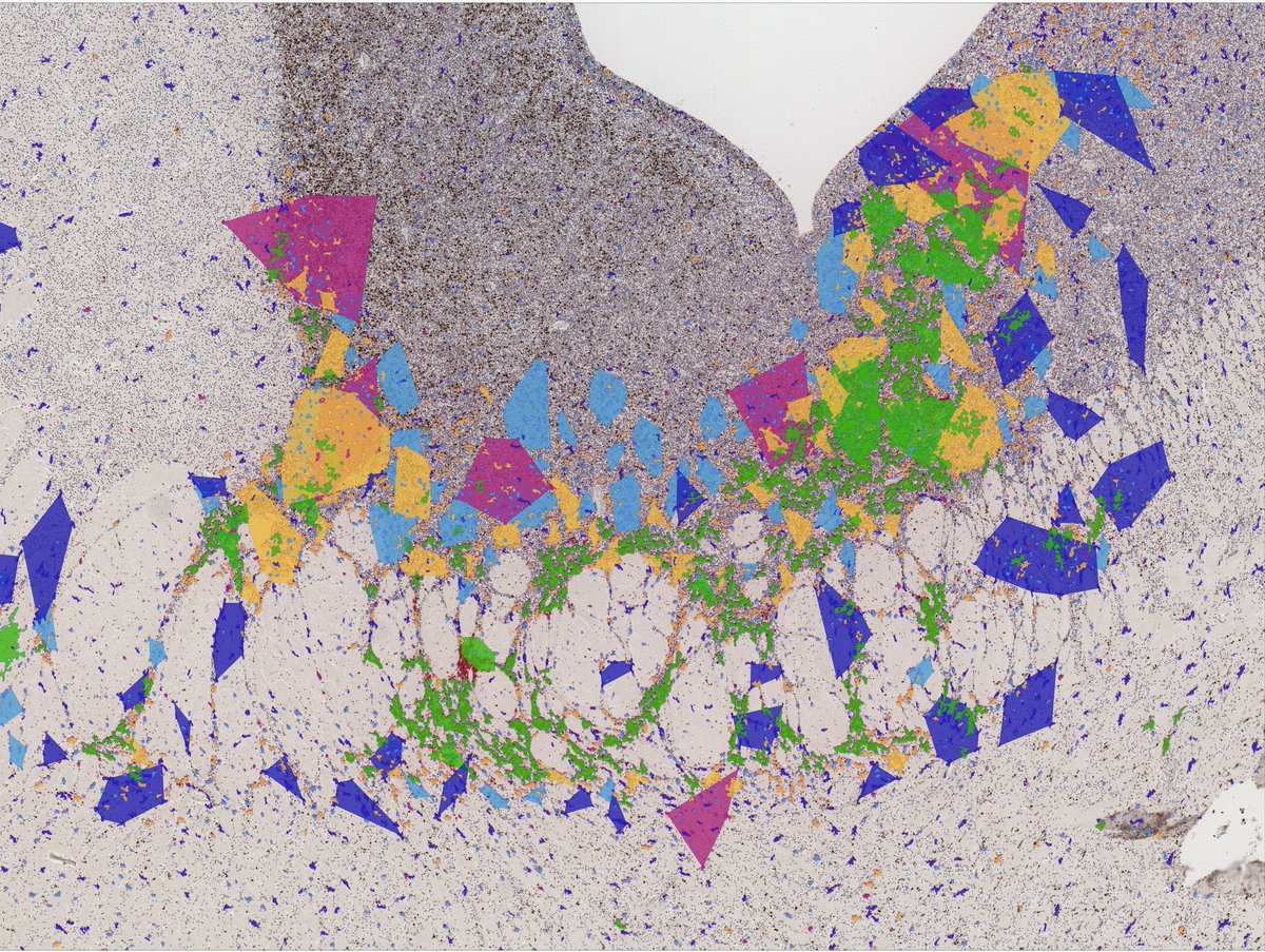 Unraveling Microglial  Spatial Organization in the Developing Human Brain with DeepCellMap,  a Deep Learning Approach Coupled to Spatial Statistics:

a new method to quantify spatio-temporal organization, @DavidMenassa1 <a href="/StatBioImag/">Thibault Lagache</a> 
<a href="/PerochonTheo/">Théo Perochon</a> 
biorxiv.org/content/10.110…