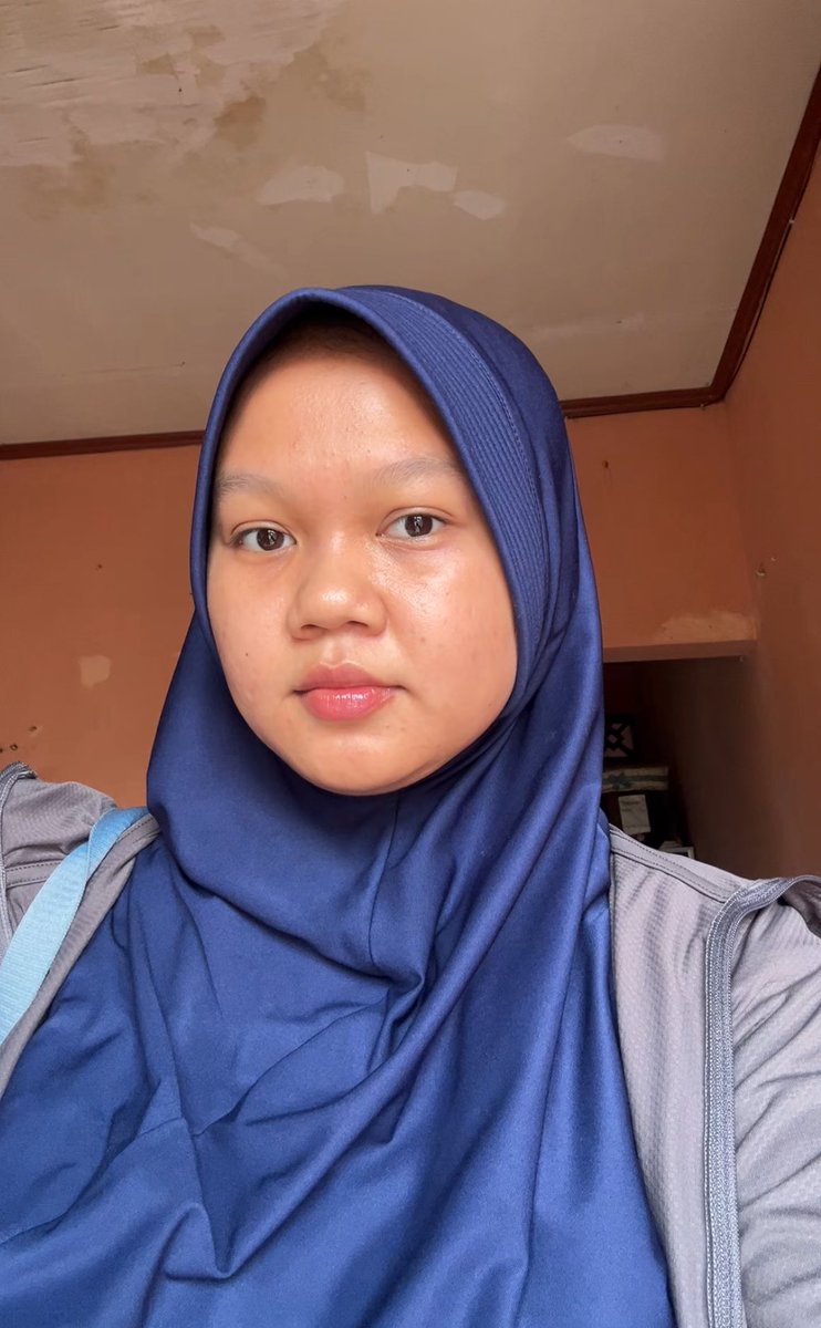 Pliss kalo kalian ngerasa rajin pake Skincare tapi PROGRESSNYA GITU GITU AJA

Plisss cobain treatment walaupun cuma sekali 🥲 harganya cuma 300 ribu🥹🫶🏻

Ini day 1 after treatment dan di take pake kamera belakang