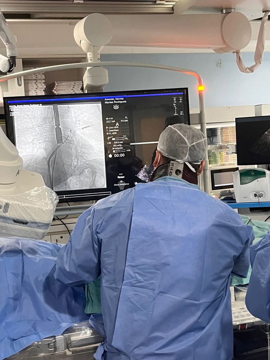 AdrianoKochi's tweet photo. Left atrial appendage occlusion with the Amulet device successfully performed yesterday, with the distinguished collaboration of Dr. @fvassallomd . #epeeps #cardiotwitter #ICEeyes #AmplatzerAmulet #abbott #SOBRAC #SBHCI @SobracO @sbc_cientifico @sbhci #LAAO https://t.co/YuyDCoA2cT