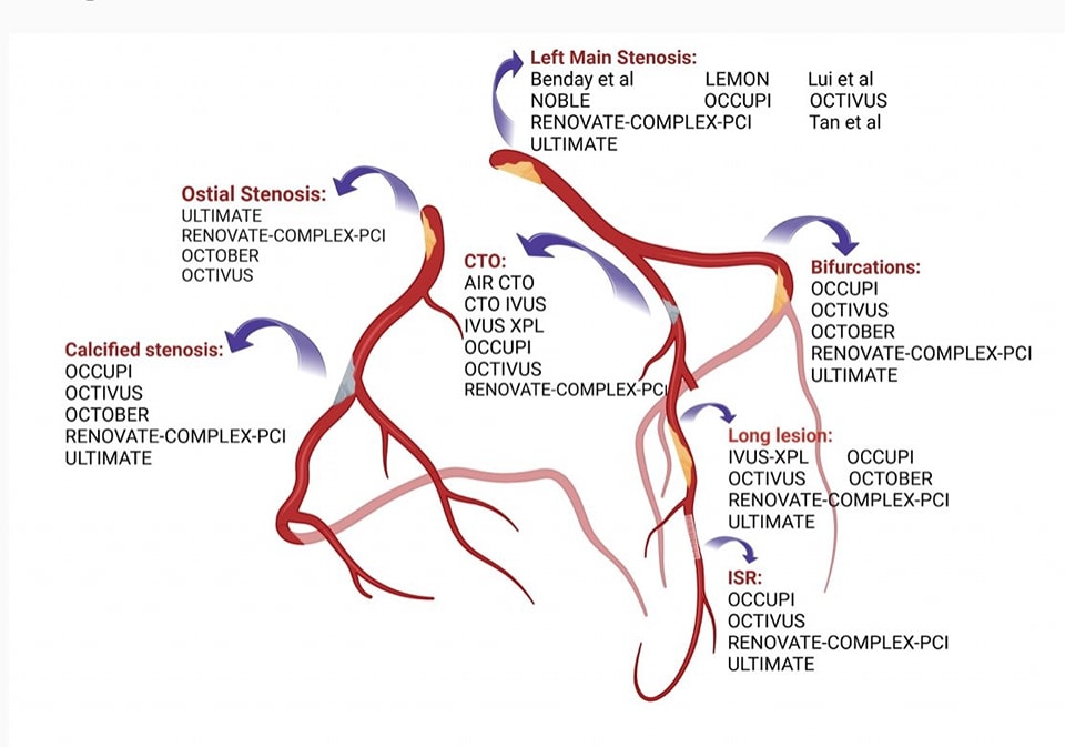 The Heart (@zheart11768530) on Twitter photo 🔴Image guided PCI of the coronary arteries⤵️ #2024Review #OpenAccess
The latest evidence that informed the recent guideline recommendations & expand on the specific role of the different imaging modalities before, during, & after PCI bit.ly/4fZOnU0 🔴Image guided PCI of the coronary arteries⤵️ #2024Review #OpenAccess
The latest evidence that informed the recent guideline recommendations & expand on the specific role of the different imaging modalities before, during, & after PCI bit.ly/4fZOnU0
