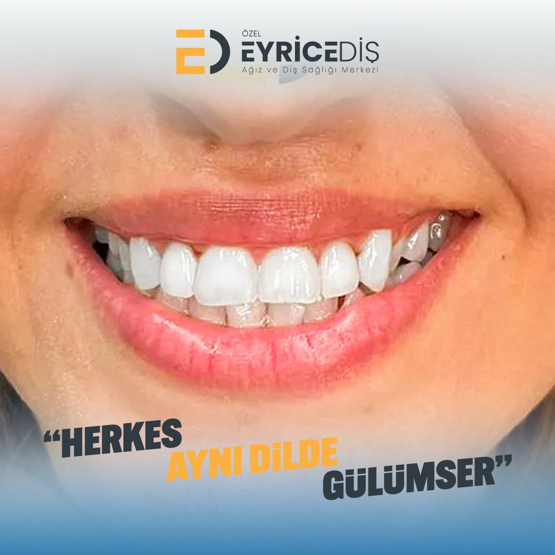 Daha Detaylı Bilgi Ve Randevu İçin;

📞 444 1 496
✉️ info@eyricedis.com.tr
🌐 eyricedis.com.tr
📍 Esentepe Mah. Kasap Sok. No:1 FSM Bul. Nilüfer/Bursa