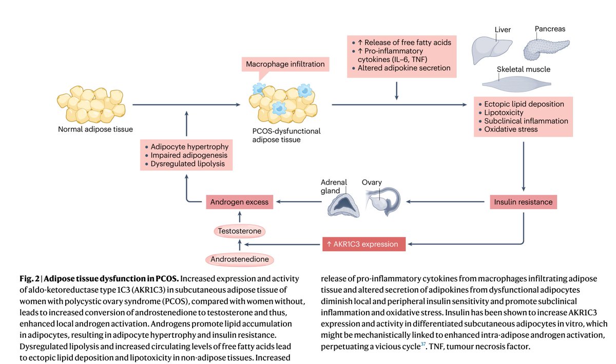 Adipose tissue dysfunction in #PCOS. Androgens promote lipid accumulation in adipocytes, resulting in adipocyte hypertrophy and insulin resistance.
nature.com/articles/s4157…