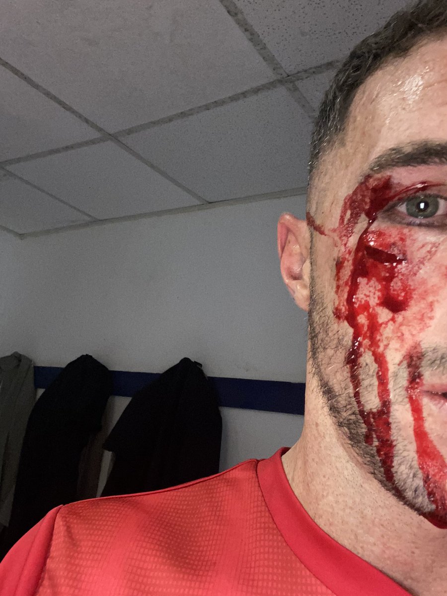 3 points and an elbow butty UTS 💙