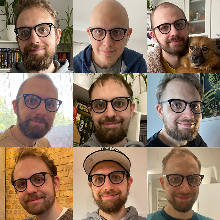 Timi_093's tweet image. Two years ago I was getting ready for a chemo.

In October 2022 I felt something is wrong. A lump in my testicle. I mean, I felt it there for a few months. I waited too long to do something with it. I was stupid. It was cancer.

I share my journey here, again. Two weeks after…
