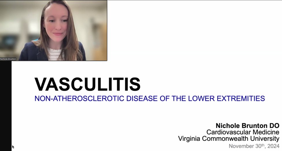 Fantastic SVM representation at  the joint session on Nonatherosclerotic Arterial Disease of the Leg with <a href="/SVM_tweets/">Society for Vascular Medicine | SVM</a> and VAS European Foundation in Angiology/Vascular Medicine during the EADays 2024 Conference. Kudos to <a href="/DKadiandodov/">Daniella KadianDodov</a> <a href="/AndrewDicksMD/">Andrew Dicks</a> <a href="/NicholeBrunton/">Nichole Brunton, DO</a> <a href="/Doc_RKR/">Randy K. Ramcharitar</a>!