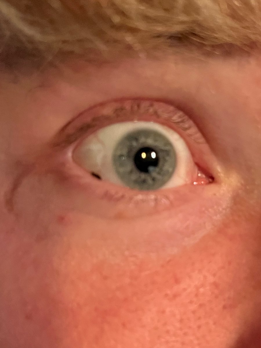 a bug flew in my eye while running yesterday and my friend pointed out that the bug was STILL in my eye 6 hours later…