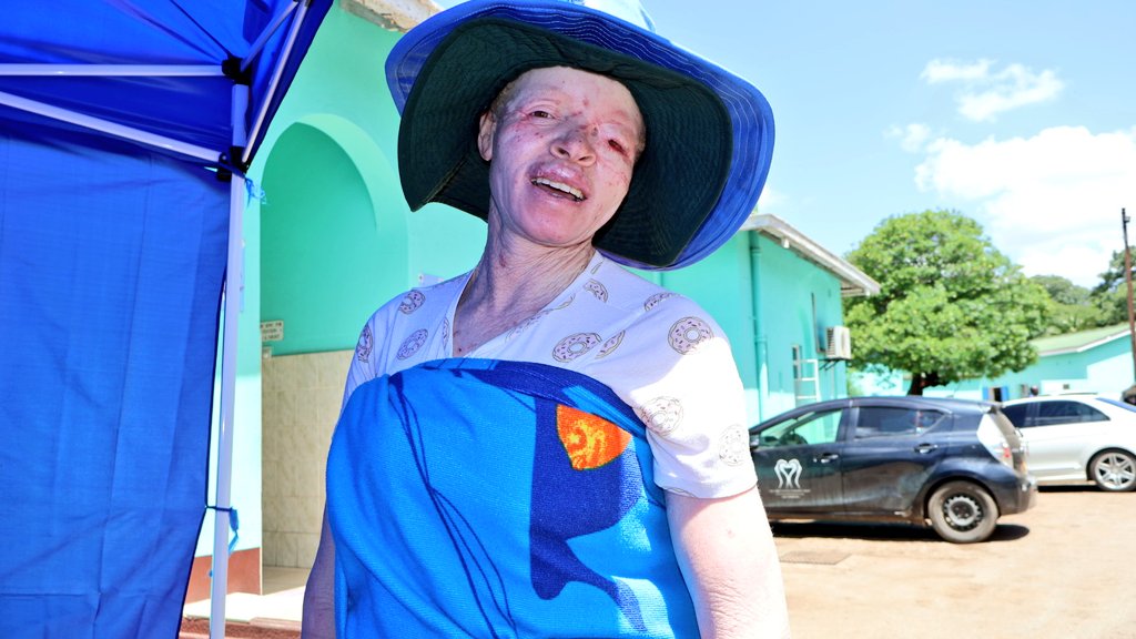 I would like to take this moment to thank <a href="/PGHZIM/">Parirenyatwa Group of Hospitals</a> ( Parirenyatwa Hospital) surgeons for conducting a very complex operation on Rodah Bulabula's eye which had skin cancer &amp; is now healing. She was jovial and happy when l saw her in Gweru. Siyabonga <a href="/MoHCCZim/">Ministry of HealthZW</a> for such positive work