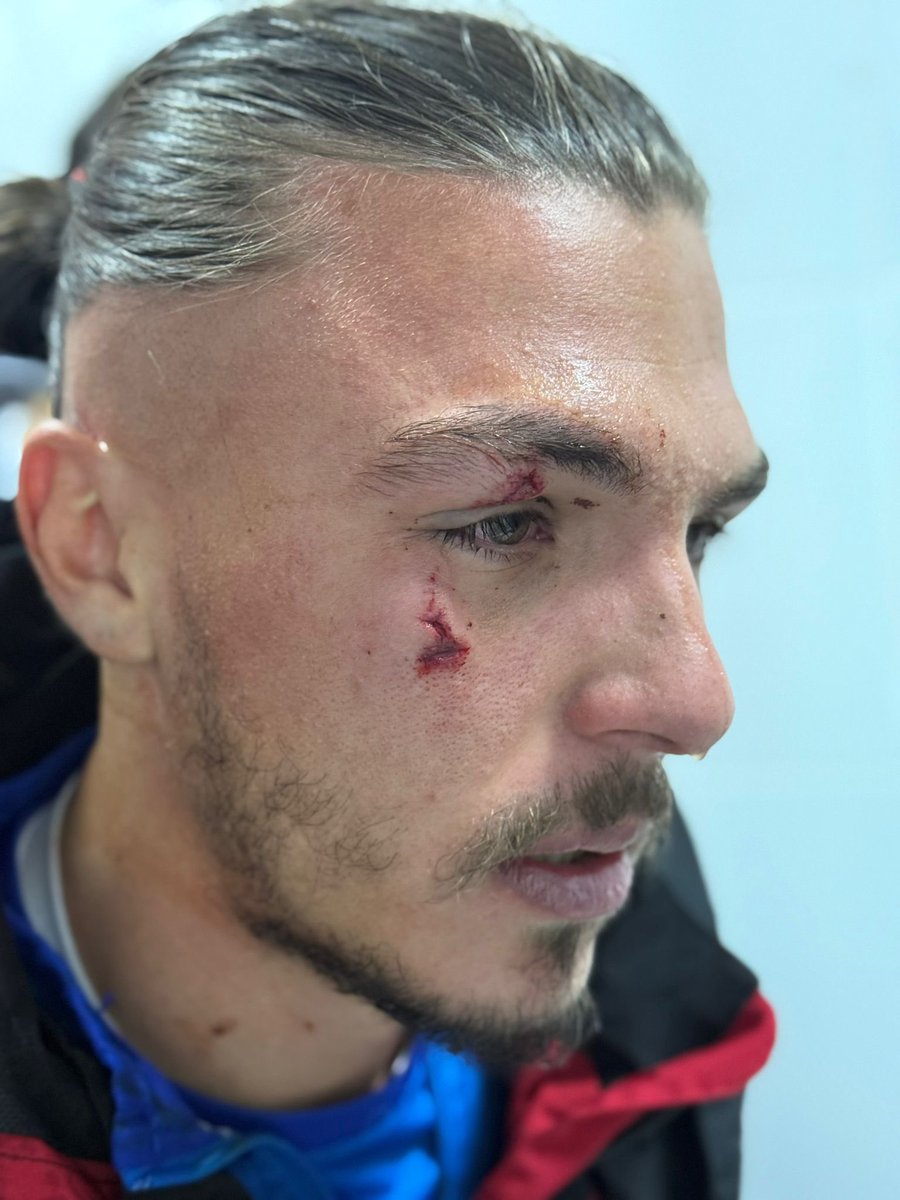 MehmetEminEtik's tweet photo. BAL Ligin’de acayip şeyler oluyor. Soyunma odasında futbolcumuz Barış Dede’ye saldıran Bartınsporun Vefa Gültek isimli sözde futbolcusunu rapor eden bir gözlemciniz yok mu ? @TFF_Org #GSvEYP #şike https://t.co/dam0148znU