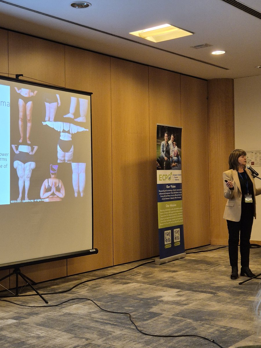 Really looking forward to hearing Dr Erla Sveinsdottir speak now at the Science of Obesity &amp; NCD Awareness training in Lisbon. 
This is much closer to home and another diagnosis which I am waiting on.
"Obesity &amp; Lipoedema"
<a href="/ECPObesity/">ECPO</a> #NCDcollaboration