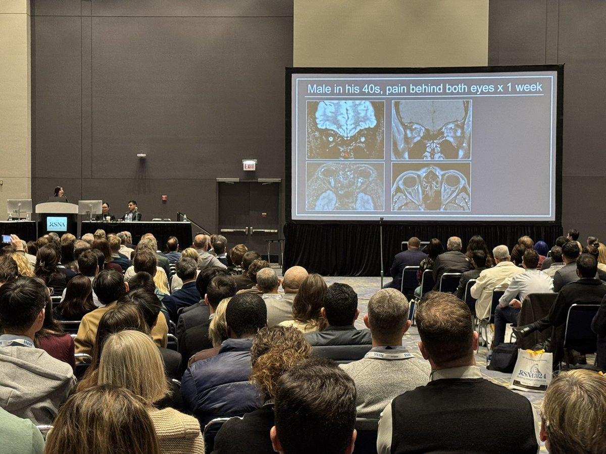 Amish Doshi (@amishdoshimd) on Twitter photo Great way to start off #RSNA2024 with infections of the brain, head and neck, and spine with a packed room! <a href="/tabby_kennedy/">Tabby A. Kennedy, MD</a> <a href="/KambizNael/">Kambiz Nael</a> <a href="/NancyPhamMD/">Nancy Pham</a> <a href="/RSNA/">RSNA</a> Great way to start off #RSNA2024 with infections of the brain, head and neck, and spine with a packed room! <a href="/tabby_kennedy/">Tabby A. Kennedy, MD</a> <a href="/KambizNael/">Kambiz Nael</a> <a href="/NancyPhamMD/">Nancy Pham</a> <a href="/RSNA/">RSNA</a>