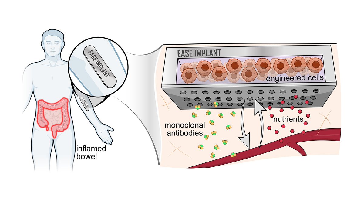 MayoRegMed's tweet photo. #Mayo Clinic is the prime site for an @ARPA_H award to develop an implantable device that acts as a living pharmacy to treat inflammatory conditions such as #Crohn's disease and #ulcerative colitis.
https://t.co/FVwvkjheIV https://t.co/lnrK3IEnoZ