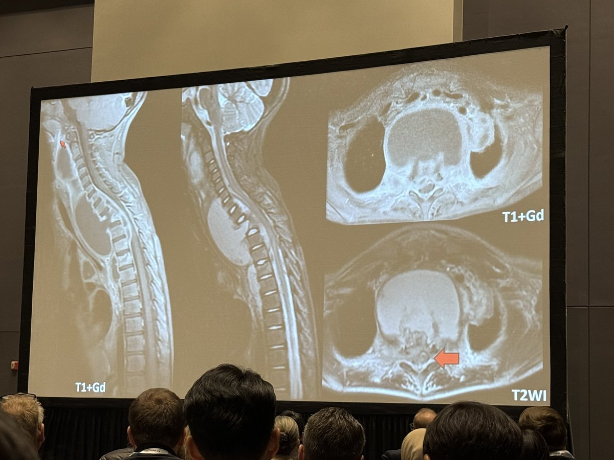 stanfordneuroimaging tweet media