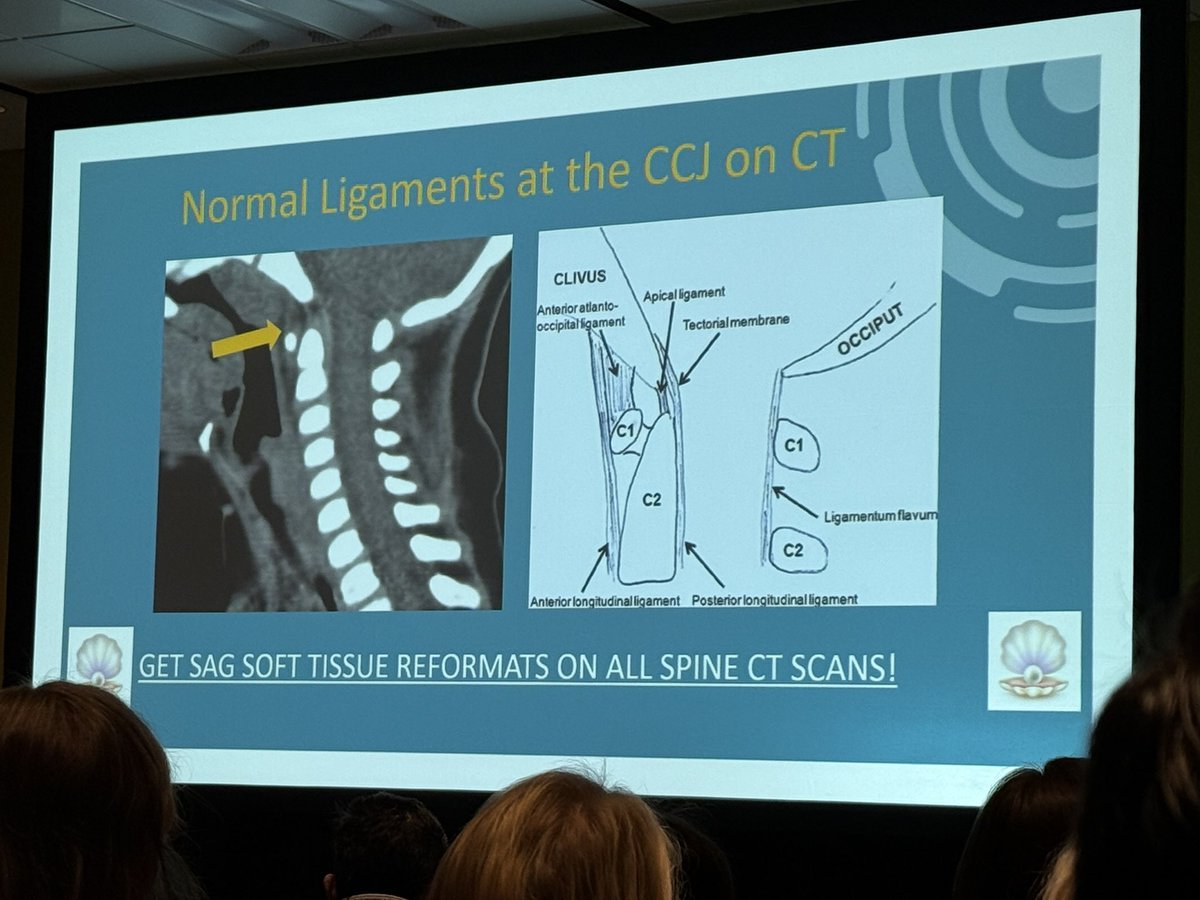 American Society of Spine Radiology (ASSR) (@the_assr) on Twitter photo Spine trauma in the pediatric patient at #RSNA24 <a href="/laura1127md/">Laura Hayes</a> shares pearls and pitfalls Spine trauma in the pediatric patient at #RSNA24 <a href="/laura1127md/">Laura Hayes</a> shares pearls and pitfalls