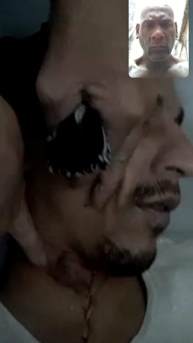 jdanielferrer's tweet image. Soy @anabelkisfg 
HA SIDO VILMENTE  ASESINADO  MANUEL DE JESÚS GUILLEN ESPLUGAS, PRESO POLÍTICO MIEMBRO UNPACU, PROMOTOR DE CUBA DECIDE Y MANIFESTANTE DEL 11/J, DE LA HABANA CONFINADO EN PRISION COMBINADO DEL ESTE.
JUSTICIA PARA MANUEL  DE JESÚS Y TODOS NUESTROS MÁRTIRES.…