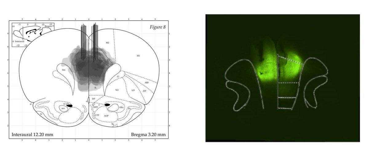 SfN Journals (@sfnjournals) on Twitter photo #eNeuro | <a href="/ShelbyMWhite1/">Shelby M. White</a>, <a href="/CC_Lapish/">Christopher C. Lapish</a>. et al. investigated the neural basis of impulsivity and impulse control. Using an important paradigm for assessing impulse control in rats, they discovered that disrupting anterior cingulate cortex activity during the paradigm increases #eNeuro | <a href="/ShelbyMWhite1/">Shelby M. White</a>, <a href="/CC_Lapish/">Christopher C. Lapish</a>. et al. investigated the neural basis of impulsivity and impulse control. Using an important paradigm for assessing impulse control in rats, they discovered that disrupting anterior cingulate cortex activity during the paradigm increases