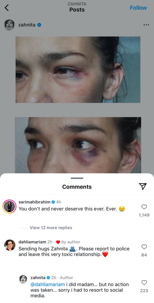 annazrulan's tweet photo. Kena dera, report polis tak jalan. Takyah tunggu masuk neraka, hidup dah serupa dalam neraka. Jantan guna kekerasan is the lowest IQ ever! https://t.co/uLONIDs5EA