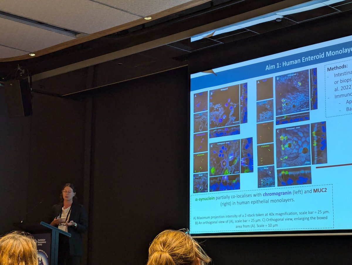 WAneuroscience's tweet image. Four minutes LET&apos;S GOOOOOO @anastazjag_ &apos;s #DataBlitz at #ANS2024