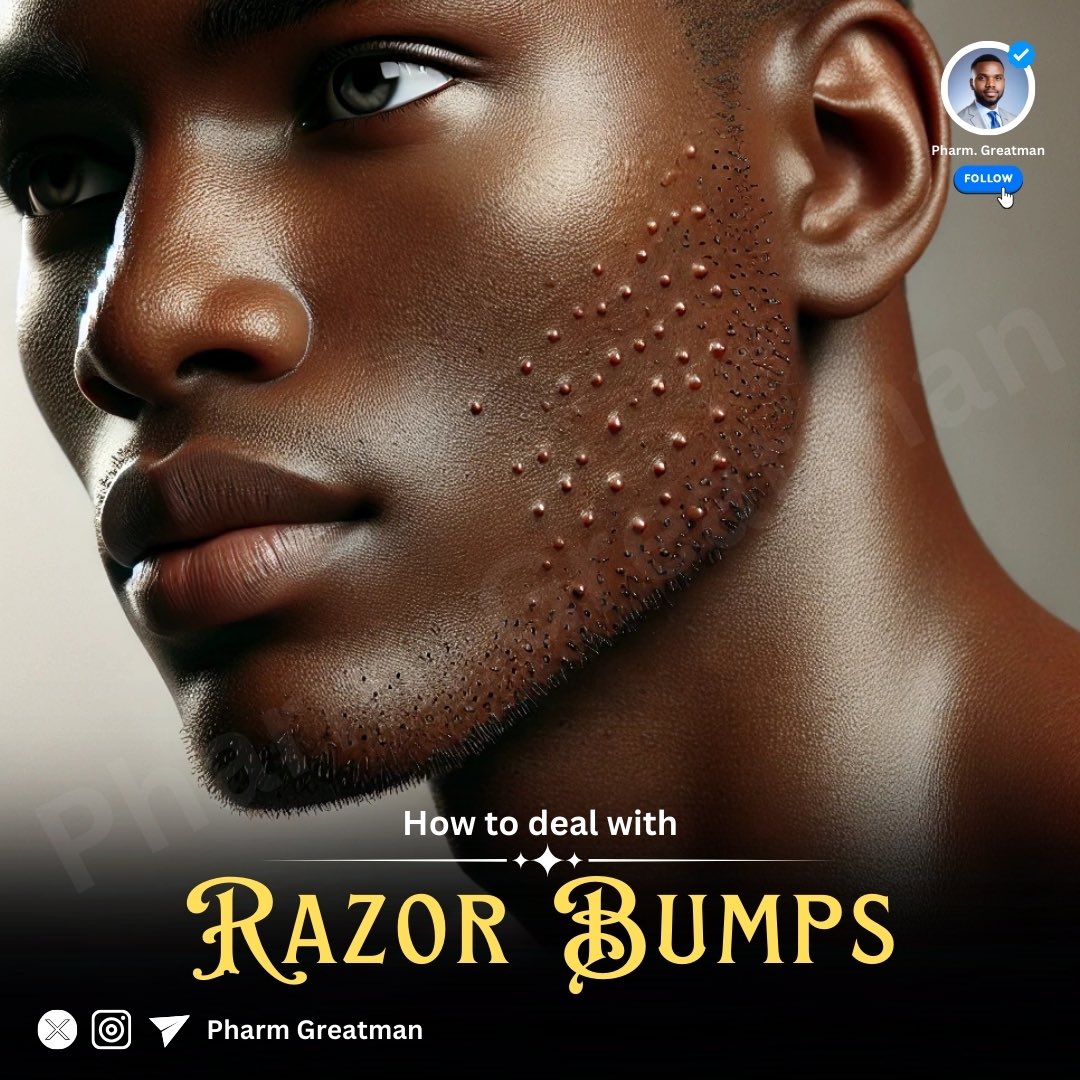 OGreat6's tweet photo. DEALING WITH RAZOR BUMPS 

Tired of dealing with itchy, painful razor bumps after shaving? 

You’re not alone! 

This is why they happen and how you can prevent or treat them for smoother, healthier skin.

Check the thread 👇🏾 https://t.co/et0ofNMqT1