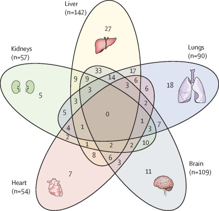 In this paper, my colleagues in the <a href="/PHOSP_COVID/">PHOSP-COVID study</a> consortium evaluated the excess burden of multiorgan abnormalities after hospitalisation with COVID-19. Physical imaging of common LC symptoms. Patients were assessed at a median of 5 months after hospital discharge. Compared with