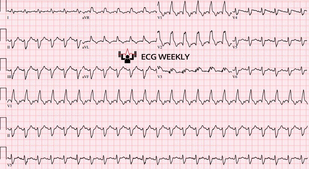 ECGWeekly tweet media