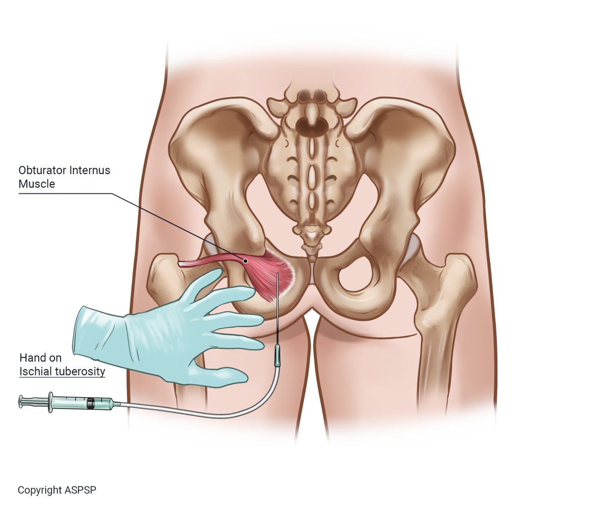 American Society for Post Surgical Pain tweet media