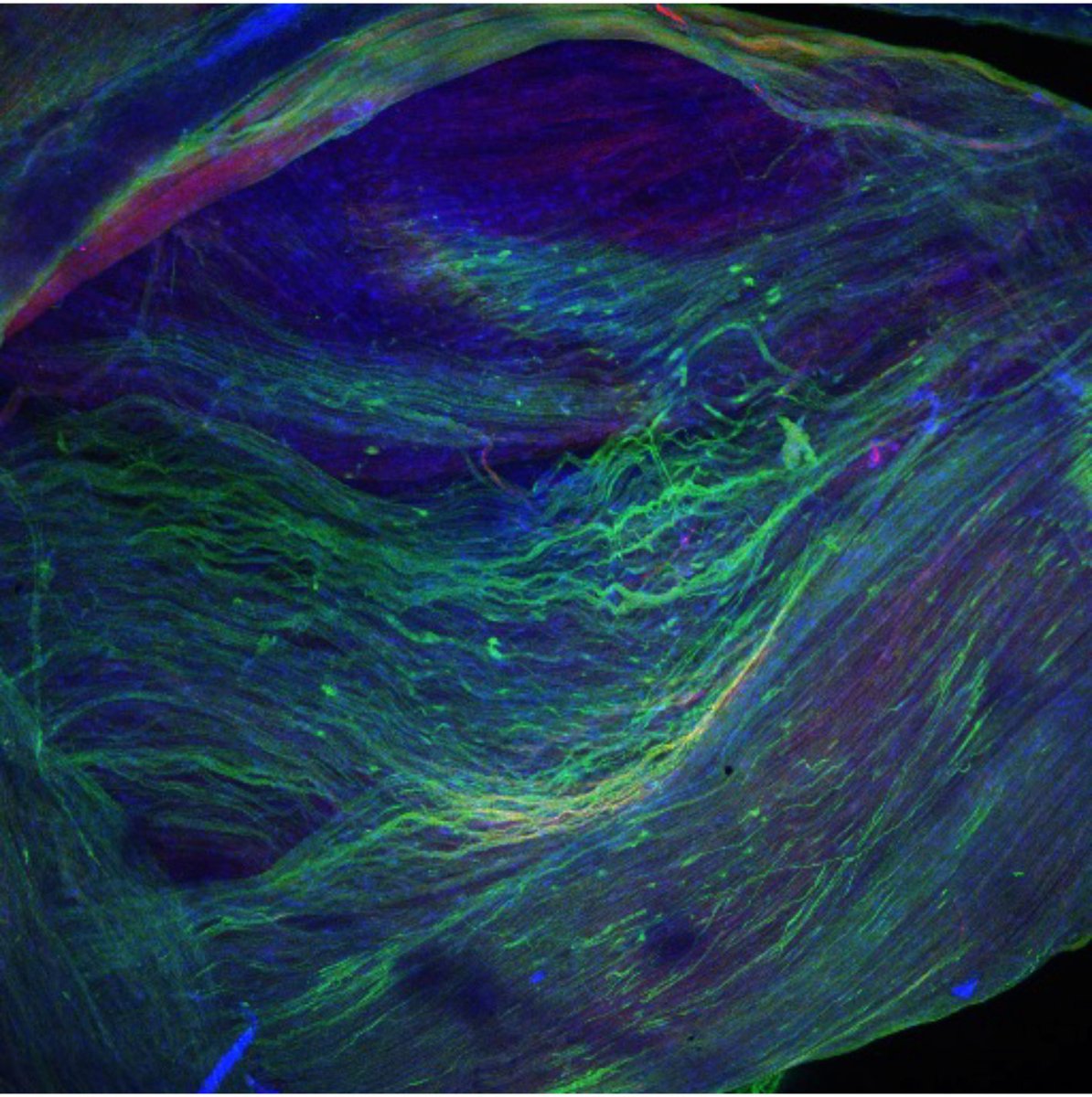 🔬Con más de 6000 #ER y solo el 6% con tratamientos, el reposicionamiento de fármacos es clave🧬 En #CharcotMarieTooth trabajamos con inhibidores de HDAC6 como posible terapia para esta neuropatía sin cura💡GRACIAS <a href="/FederacionAsem/">Federación ASEM</a> <a href="/FundIsabelGemio/">Fundación Isabel Gemio</a> 🩵
fundacionisabelgemio.com/que-hacemos/en…