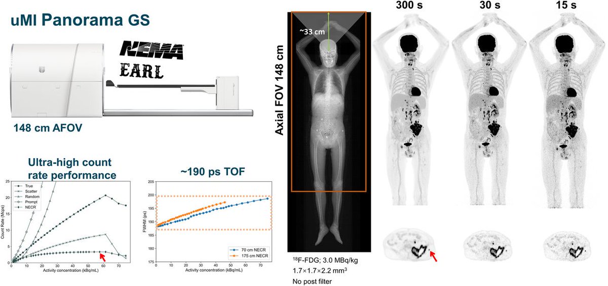 JournalofNucMed's tweet image. Performance characteristics of a new generation 148-cm axial field-of-view uMI panorama GS PET/CT system with extended NEMA NU 2-2018 and EARL standards. ow.ly/CmC250U6mbi

#NuclearMedicine #MedicalImaging #PETscan