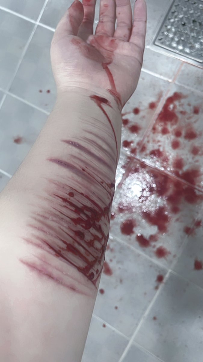 Leber0409's tweet photo. 시발 왜 나한테만 지랄인데 개새끼들아 좆같네 뒤에서 쳐 씨부릴거면 앞에와서 말해시발 존나 패버리게 엄마 뒤진년들아
(재업)
#분노전시 #자해 #쫄보자해 https://t.co/3zckNOuWlT