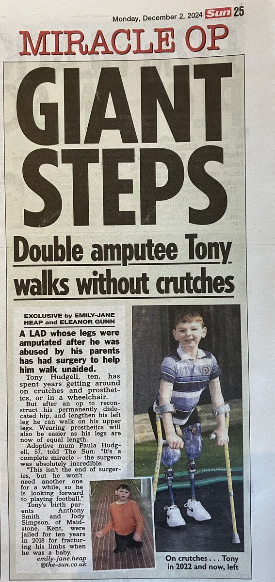 Eleanor (@eleanorjgunn) on Twitter photo EXCLUSIVE in today’s <a href="/TheSun/">The Sun</a>: Brave Tony Hudgell walks without crutches for the first time after life-changing surgery
<a href="/ferraripress/">Ferrari Press Agency</a> <a href="/paula_hudgell/">Tony Hudgell BEM (BCyA) Paula Hudgell OBE</a> <a href="/TonyHudgell_fdn/">Tony Hudgell Foundation</a> <a href="/emilyjaneheap/">E-J</a> EXCLUSIVE in today’s <a href="/TheSun/">The Sun</a>: Brave Tony Hudgell walks without crutches for the first time after life-changing surgery
<a href="/ferraripress/">Ferrari Press Agency</a> <a href="/paula_hudgell/">Tony Hudgell BEM (BCyA) Paula Hudgell OBE</a> <a href="/TonyHudgell_fdn/">Tony Hudgell Foundation</a> <a href="/emilyjaneheap/">E-J</a>