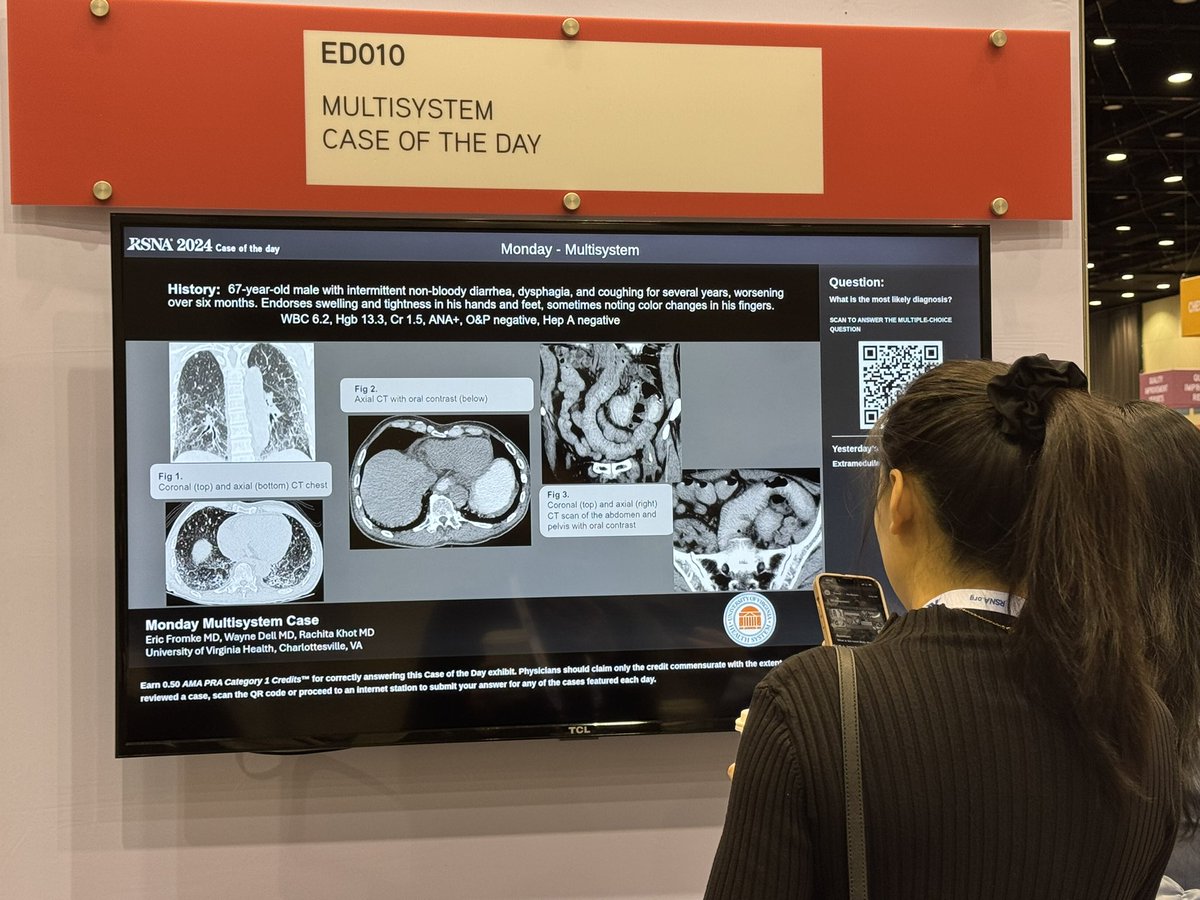 Rachita Khot (@rachitakhot) on Twitter photo #RSNA2024 checkout today’s Case of the day for multisystem by <a href="/EricFromke/">Eric Fromke</a>, Wayne Dell <a href="/UVARadiology/">UVA Radiology</a> #RSNA2024 checkout today’s Case of the day for multisystem by <a href="/EricFromke/">Eric Fromke</a>, Wayne Dell <a href="/UVARadiology/">UVA Radiology</a>