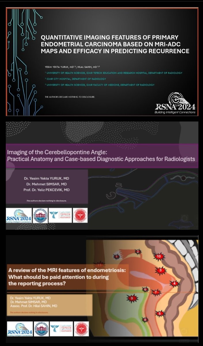 mdyesimyekta (@yesimyektayuruk) on Twitter photo I'm thrilled to announce that we have 2 educational exhibits and 1 oral presentation for #RSNA2024! If you have time, please check out our amazing works!! Special thanks to my wonderful mentors! I couldn't make it without you!
rsna.apprisor.org/epsAbstractRSN…
<a href="/YPekcevik/">Yeliz Pekçevik, MD</a> <a href="/HilalSahin_MD/">Hilal Şahin</a> I'm thrilled to announce that we have 2 educational exhibits and 1 oral presentation for #RSNA2024! If you have time, please check out our amazing works!! Special thanks to my wonderful mentors! I couldn't make it without you!
rsna.apprisor.org/epsAbstractRSN…
<a href="/YPekcevik/">Yeliz Pekçevik, MD</a> <a href="/HilalSahin_MD/">Hilal Şahin</a>