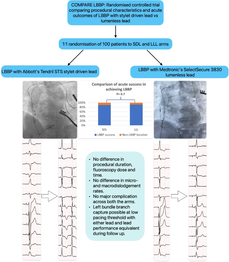 CircEP (@circulationep) on Twitter photo Introducing the first RCT comparing stylet-driven lead vs lumenless lead for left bundle branch pacing showing comparable procedural outcomes & reliable lead performance with either lead. Of course, operator learning curve remains key <a href="/PrashSanders/">Prash Sanders</a>
doi.org/10.1161/CIRCEP… Introducing the first RCT comparing stylet-driven lead vs lumenless lead for left bundle branch pacing showing comparable procedural outcomes & reliable lead performance with either lead. Of course, operator learning curve remains key <a href="/PrashSanders/">Prash Sanders</a>
doi.org/10.1161/CIRCEP…