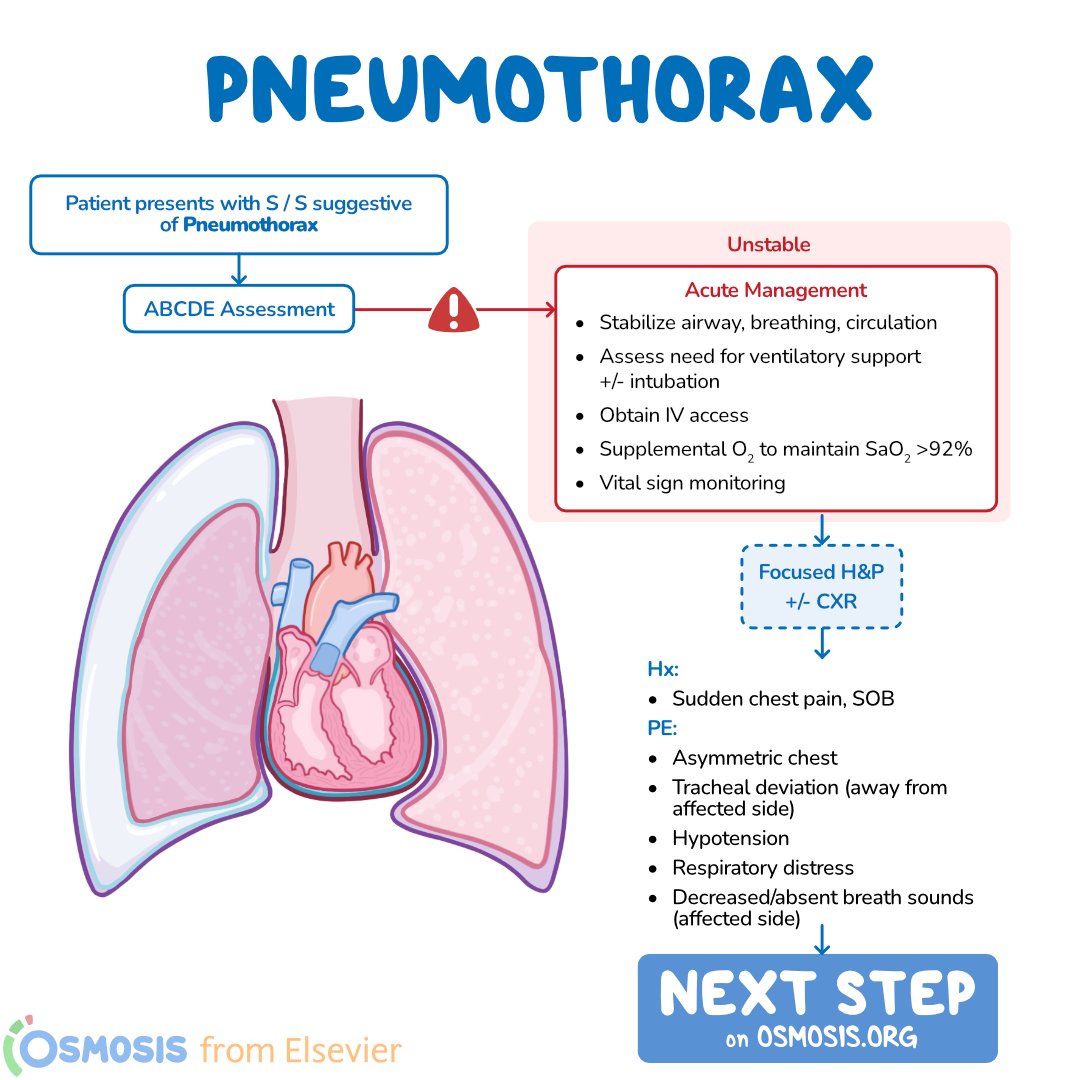 OsmosisMed's tweet photo. Today's #DecisionTreeBranch is on #pneumothorax, which refers to an abnormal presence of air within the pleural space that can result in a deflated or collapsed #lung.
Learn more: https://t.co/pRyw3A1M6g
Get a free trial of Osmosis from Elsevier: https://t.co/8xMe6PpK8X https://t.co/zpmYqMVS70