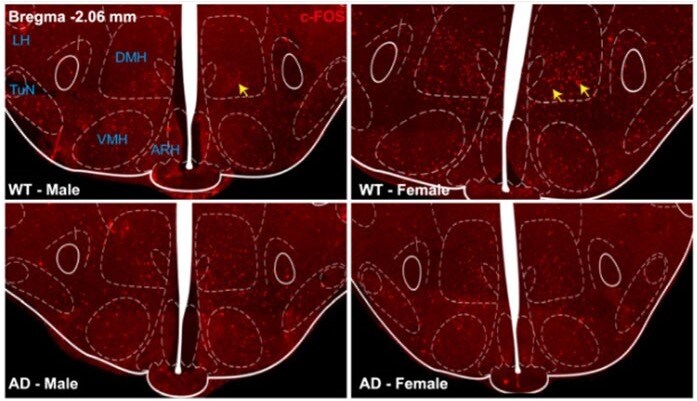 antibodiesinc's tweet image. We’re excited to share that our Anti-cFos Antibody (hubs.ly/Q02Z_tf30) was cited in a study by Qi, G. et al. (2024), &quot;Sex-specific hypothalamic neuropathology and glucose metabolism in an amyloidosis transgenic mouse model of Alzheimer’s disease.&quot;
hubs.ly/Q02Z_jtv0