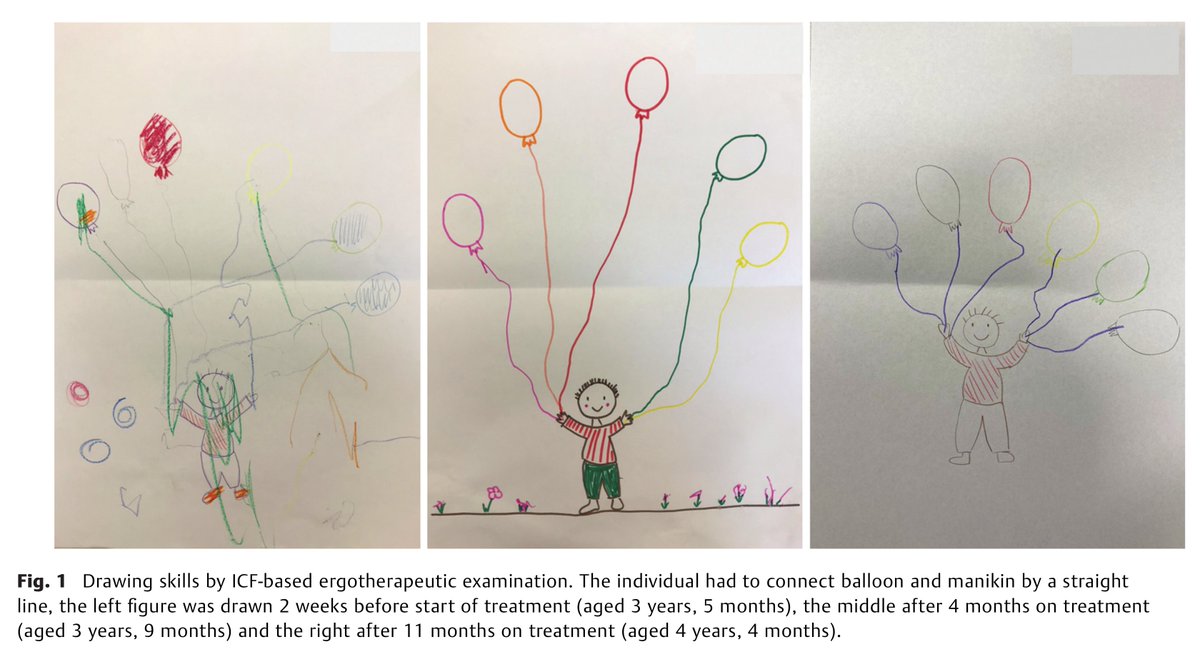 NO-Age and NO-AD Joint Venture (@noage100) on Twitter photo A very exciting one case report showing NAD+ improved motor function of an A-T kid led by Prof. Saskia Wortmann pubmed.ncbi.nlm.nih.gov/36223879/
The data were in line with one led by Hilde Nilsen
pubmed.ncbi.nlm.nih.gov/37899683/
Original preclinical <a href="/TheFangGroupUiO/">FangGroup</a> pubmed.ncbi.nlm.nih.gov/27732836/ A very exciting one case report showing NAD+ improved motor function of an A-T kid led by Prof. Saskia Wortmann pubmed.ncbi.nlm.nih.gov/36223879/
The data were in line with one led by Hilde Nilsen
pubmed.ncbi.nlm.nih.gov/37899683/
Original preclinical <a href="/TheFangGroupUiO/">FangGroup</a> pubmed.ncbi.nlm.nih.gov/27732836/