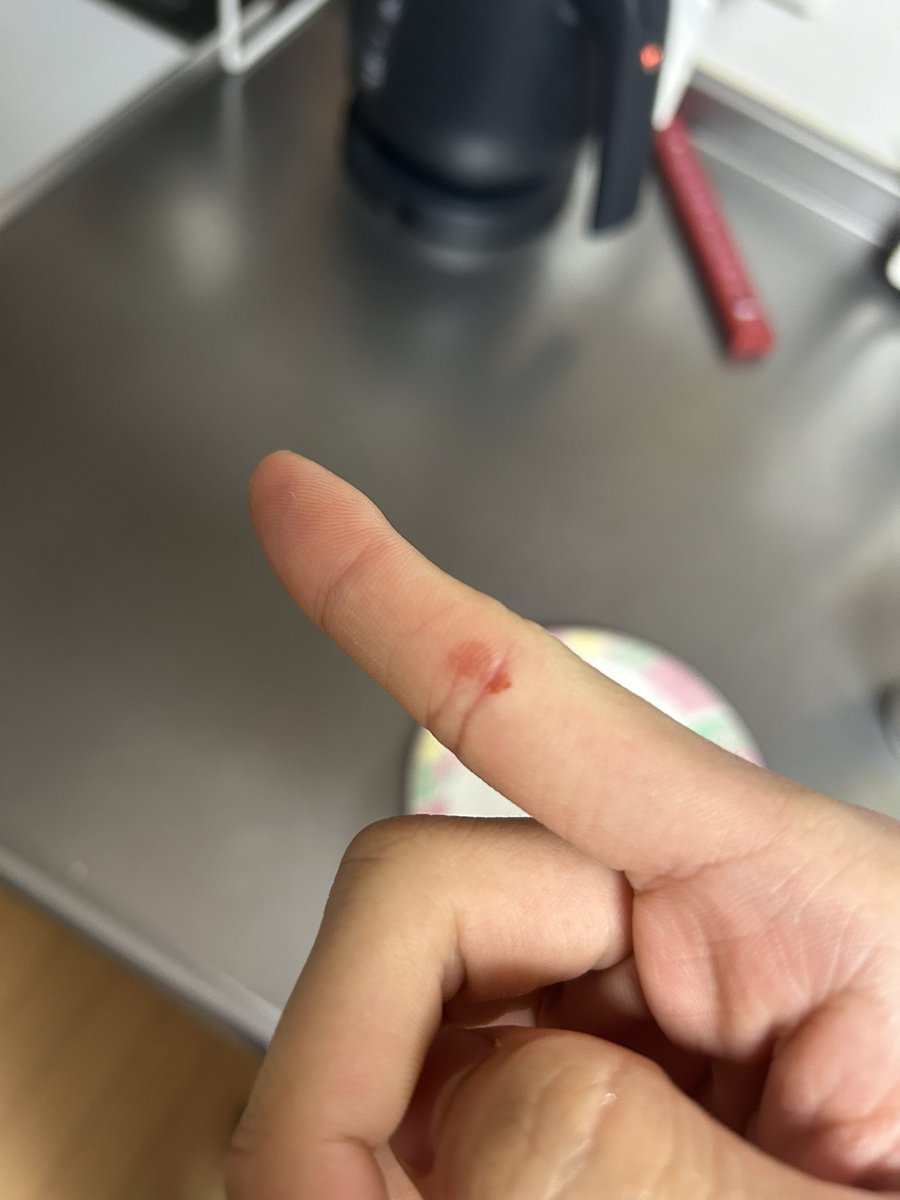 リード何本も抜き差ししてたら血豆みたいなん出来た
最近コルク全部硬い