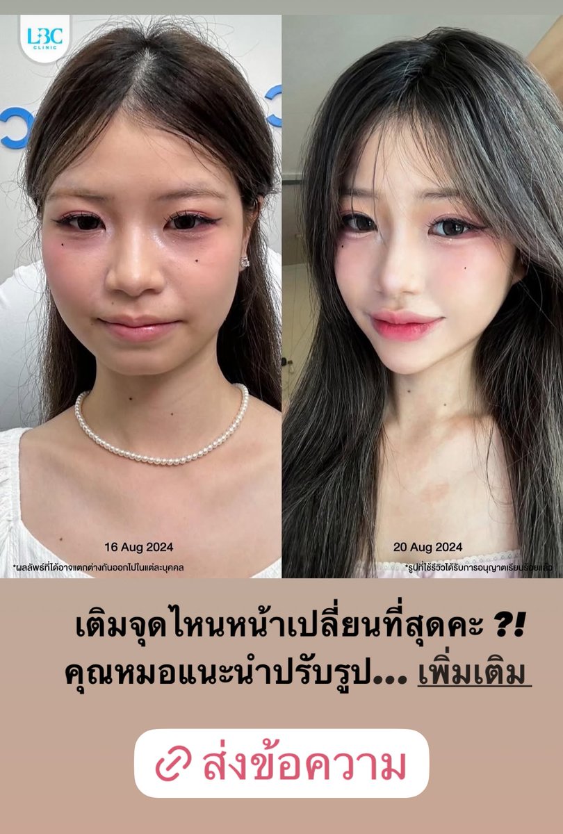 cynthiabesun's tweet photo. คนละคนเดียวกันไหมคะ หัตถการจริงมันจึ้งแบบนี้ได้เลยรึป่าว https://t.co/96MzVpl2Kn