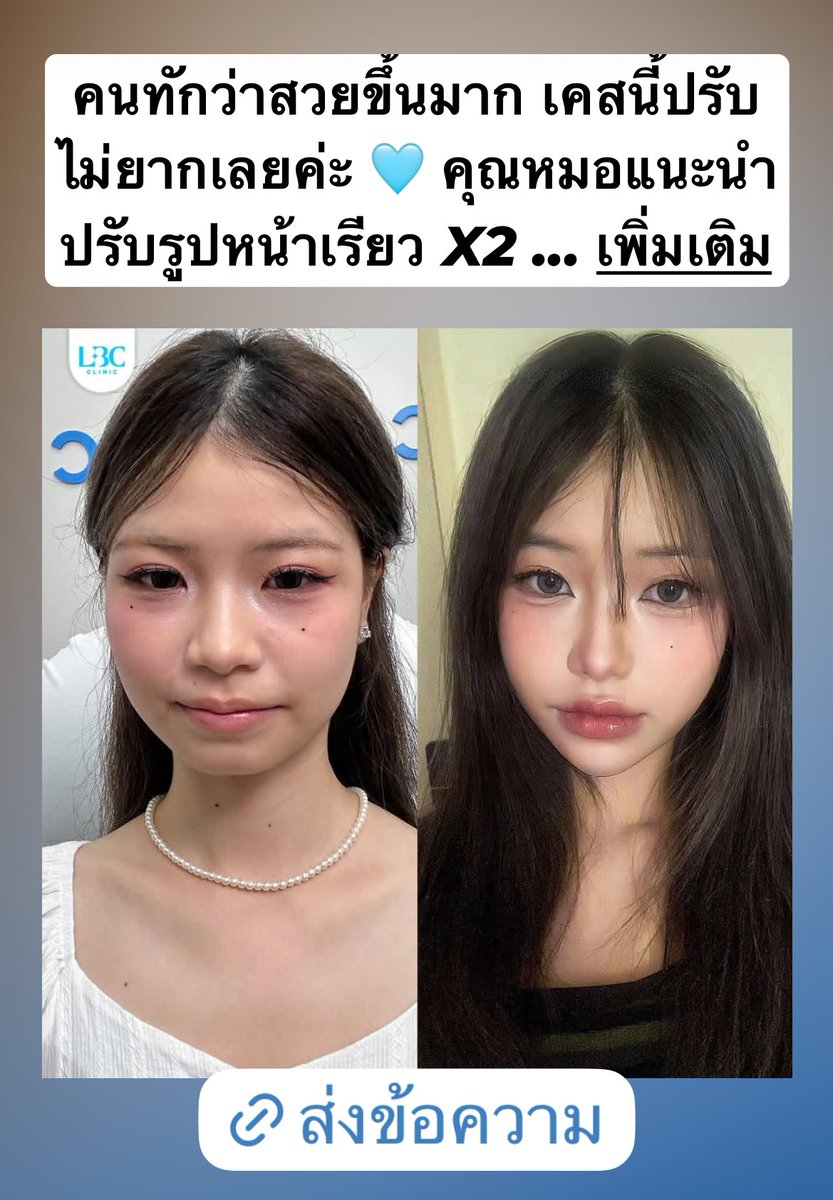 cynthiabesun's tweet photo. คนละคนเดียวกันไหมคะ หัตถการจริงมันจึ้งแบบนี้ได้เลยรึป่าว https://t.co/96MzVpl2Kn