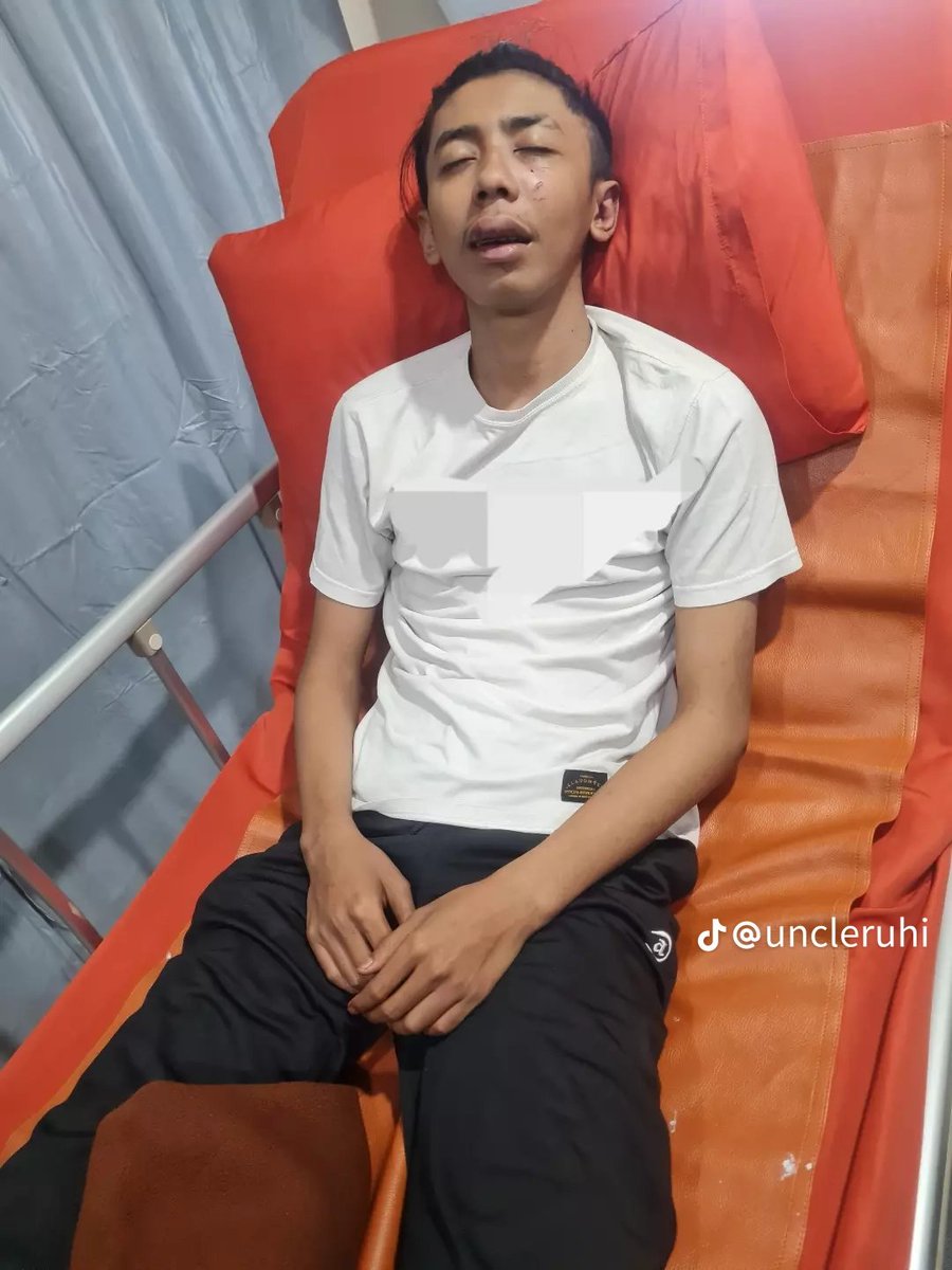 panpandjafarr's tweet photo. nazmitsq di kroyok geng motor?
source: tiktok omnya
#nazmitsq #sosis #sarapansambilpusing https://t.co/HopE0lysAS