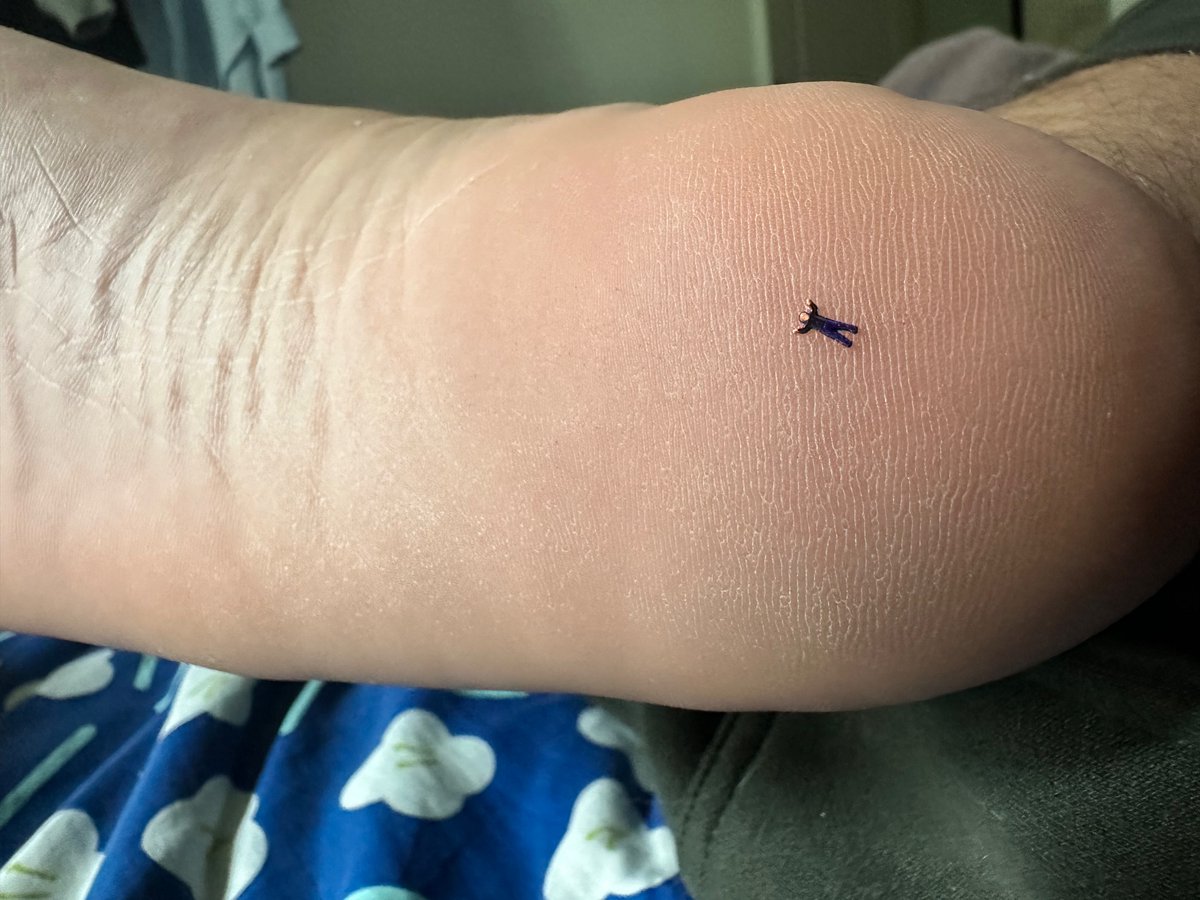 mikifeets's tweet photo. Actual pov of an ant sized “human”, it’s not that interesting really. Can’t see anything being that small, just endless wall of skin. I swear being tiny is overrated, better to be normal size and closely observe a tiny suffer 😁 https://t.co/OcfUBw1Z7q