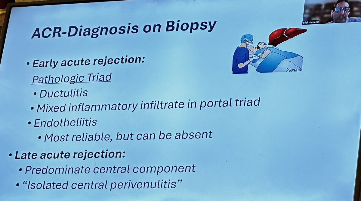 SyedGerdezi's tweet photo. Stellar 💫 talk as usual on #TCMR in LT by @BilalUCSF
🧨Risk: young recipients, CIT >15hrs, donor age ≥30, AI LD.
⏰ Early-(<3m): 15-25%, treatable.
⏰ Late (>3m): 11%, worse survival (10yr: 74% vs. 85%).
🔑: Biopsy - ductulitis, portal inflammation, endotheliitis
#PSSLD24 https://t.co/gC73n5sUvs