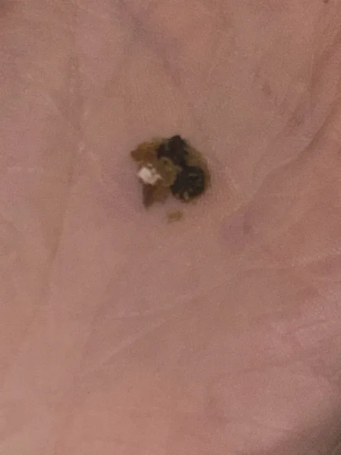 THERE IS A FLY BAKED INTO MY COOKIE????
LIKE AN ENTIRE ASS FLY??? WITH WINGS??
BAKED. INTO THIS COOKIE I WAS EATING.

WHA T THE FUCK SUPERIOR ON MAIN COOKIES

Made in a nut free facility but not fly free 🤢