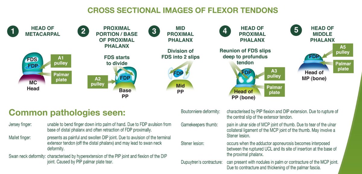 Rheumatology's tweet photo. The ASA Finger Anatomy Fact Sheet
FREE PDF
https://t.co/5DWzR87sMj https://t.co/VCnpFAwDzg
