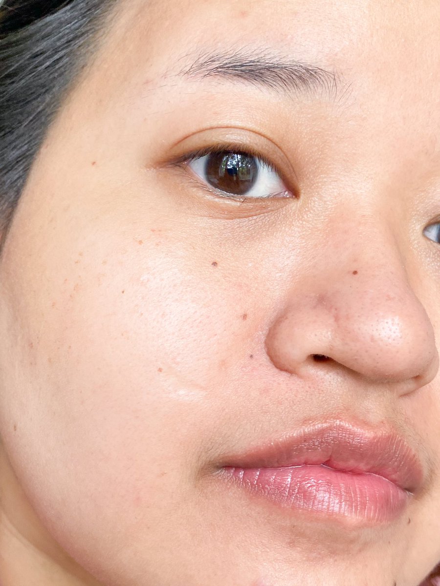 กันแดดตัวใหม่ Skintific matte fit serum หลอดม่วง ใช้แล้วฟินิชผิวโคตรแมทท์ แต่ไม่เหนียวเนอะ เนื้อคล้ายเซรั่ม ซึมไวเกิน เกลี่ยแล้วหายเลย คุมมันดีมากก ใช้เป็นเบสก่อนแต่งหน้าได้ ผิวเบลอเนียนมากกก ไปข้างนอกกลับมาหน้ายังอยู่ ไม่หยือเลย มีค่ากันแดดเต็มแม็กซ์ กันแดดได้ทั้งวัน ชอบมากกก 🌞💟✨