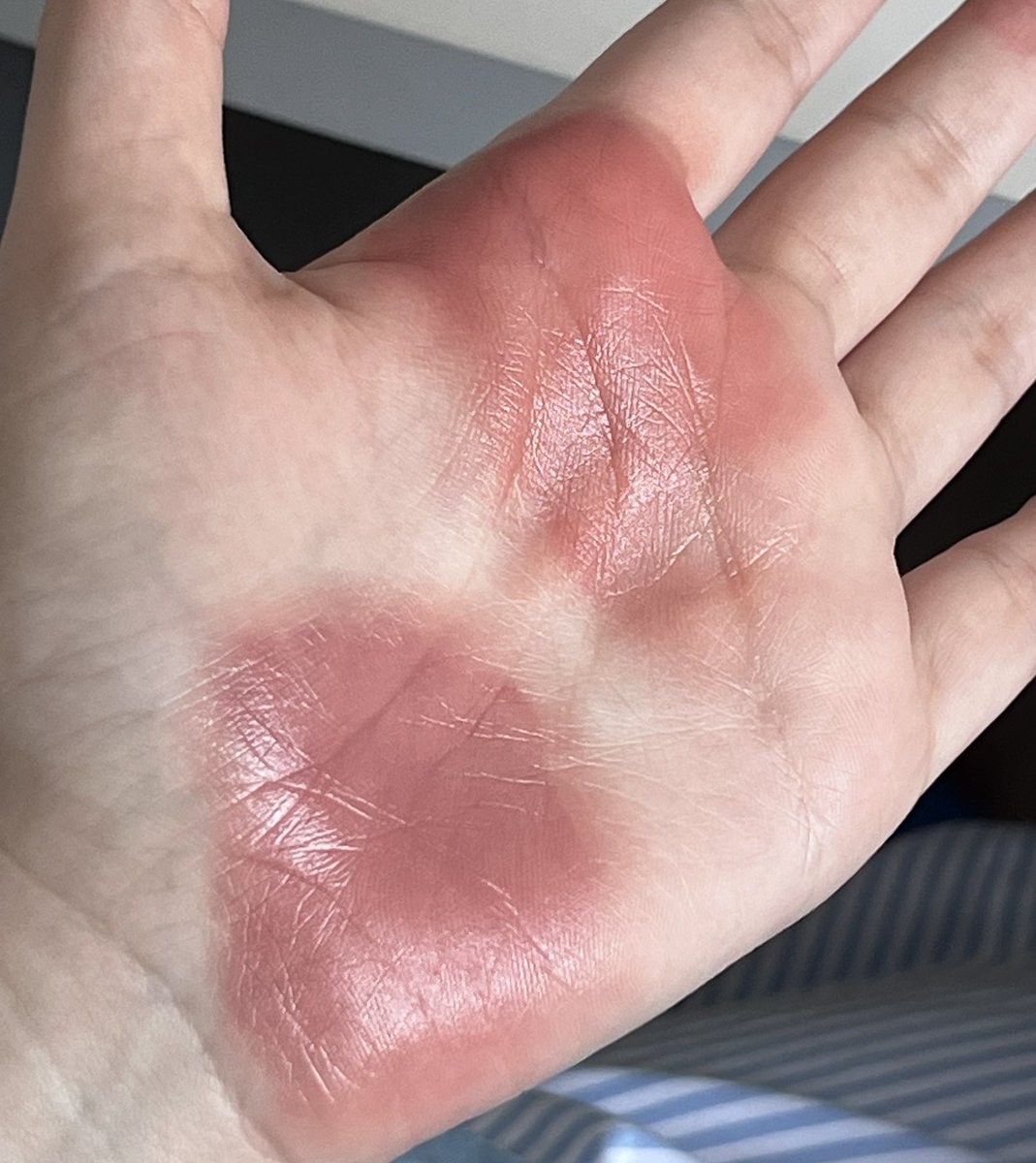 nchdaq's tweet image. สาบานว่าเป็น 2 สีที่เราหยิบบ่อยสุดช่วงสิ้นปี รู้สึกว่าเป็นนู้ดชมพูตุ่นติดน้ำตาลที่สวยมาก ดูแพงสุดๆ คริสต์มาสเดทถ้าไม่แดงคลาสสิคก็ต้องสองสีนี้🎄🧣🫗