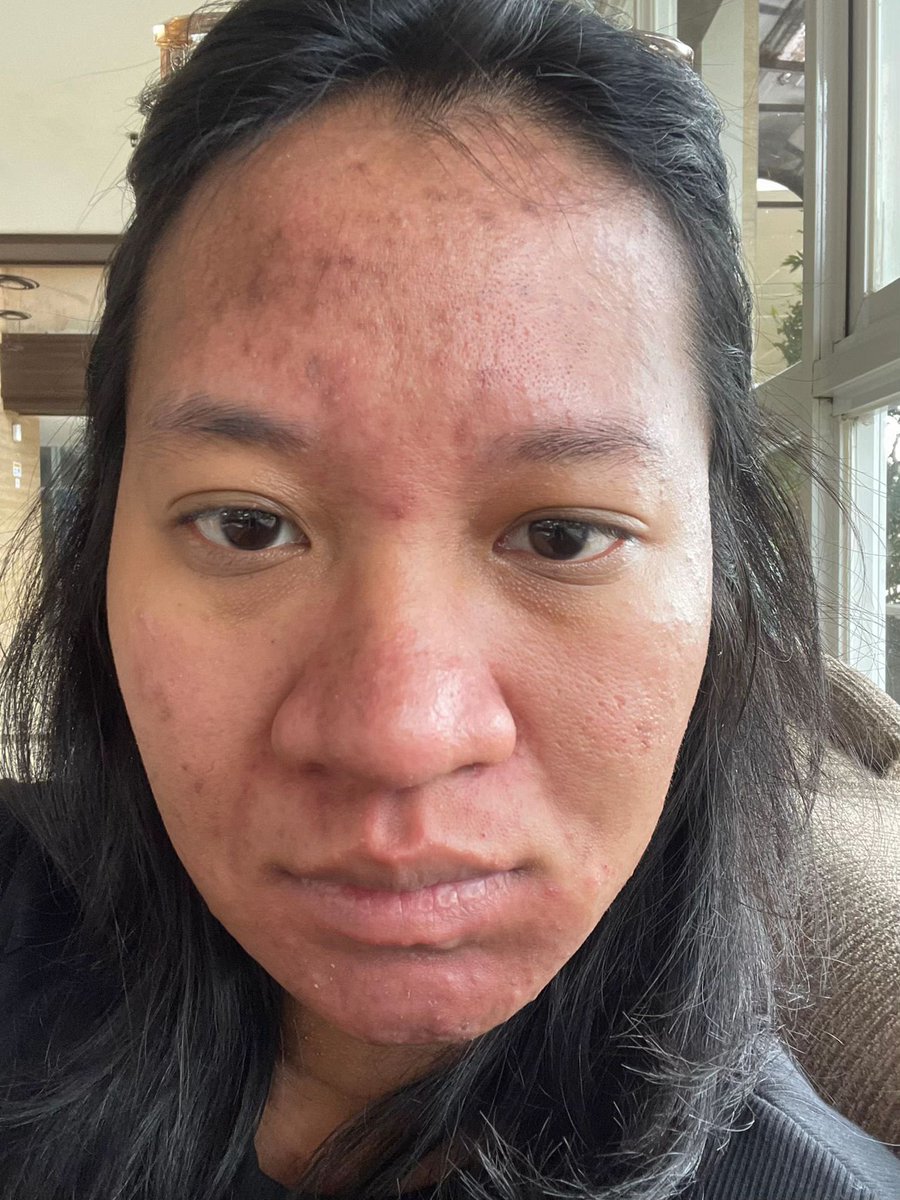 ally🦭 tweet media