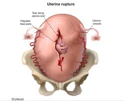 OGdukeneurosurg's tweet photo. How scary from 1-10? Treatment ? https://t.co/lBtTirqoEH