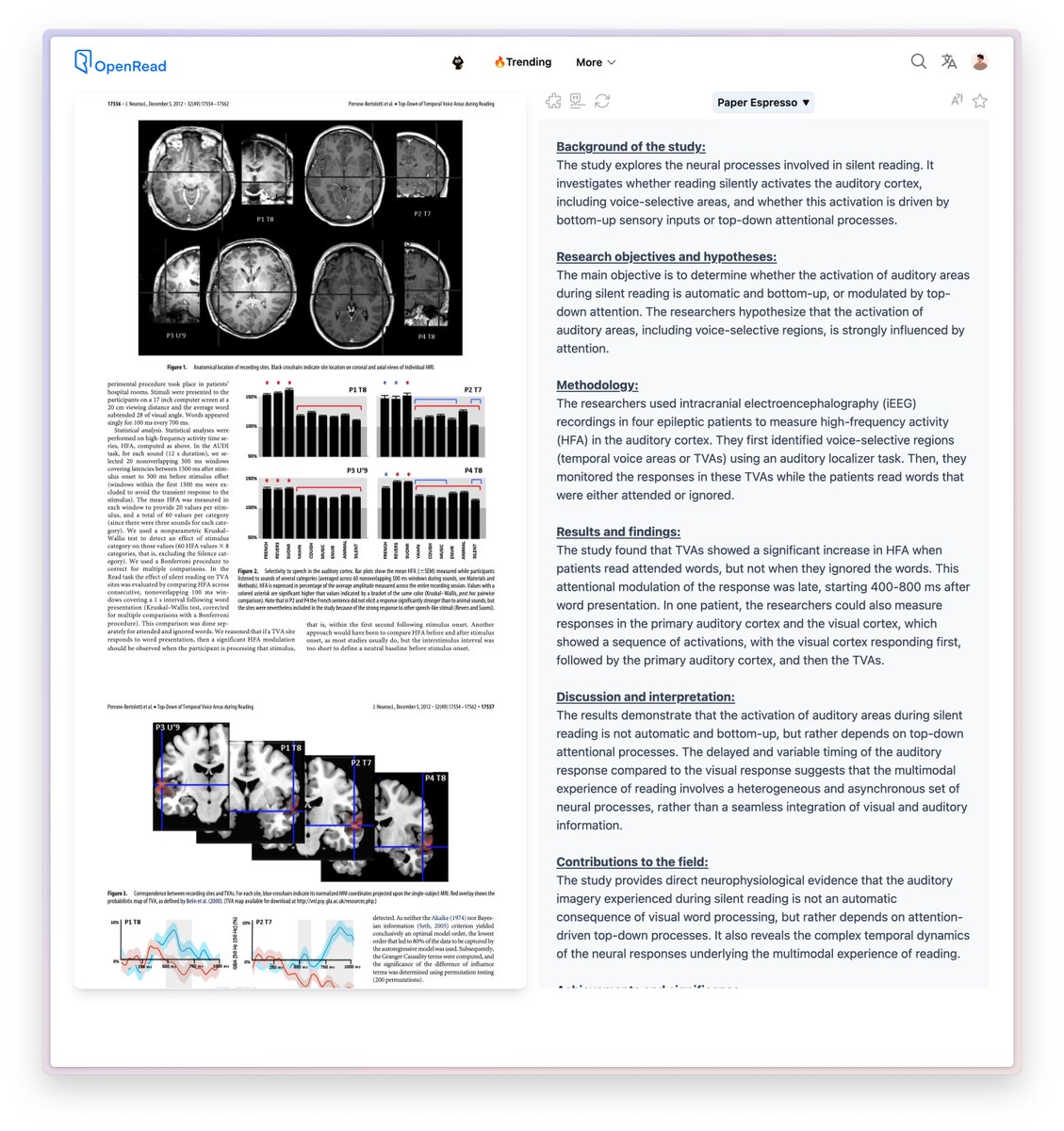 zoewangai's tweet photo. Breakdown of the paper:

The study explores the neural processes involved in silent reading. It investigates whether reading silently activates the auditory cortex, including voice-selective areas, and whether this activation is driven by bottom-up sensory inputs or top-down attentional processes.

The results demonstrate that the activation of auditory areas during silent reading is not automatic and bottom-up, but rather depends on top-down attentional processes. The delayed and variable timing of the auditory response compared to the visual response suggests that the multimodal experience of reading involves a heterogeneous and asynchronous set of neural processes, rather than a seamless integration of visual and auditory information.

full paper: https://t.co/1cxBWKHqgc