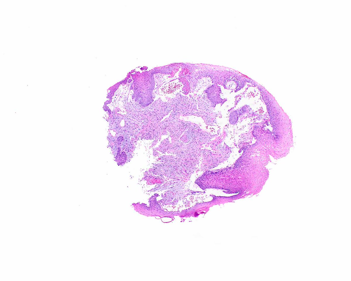 UMiami Pathology tweet media